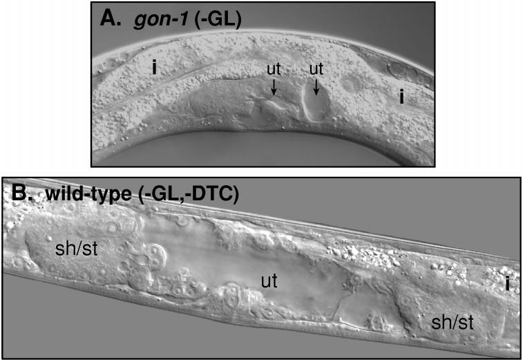 gon-1 and Gonadal Morphogenesis 391 FIG. 9. Hermaphrodite somatic gonadal structures at mid-l4.