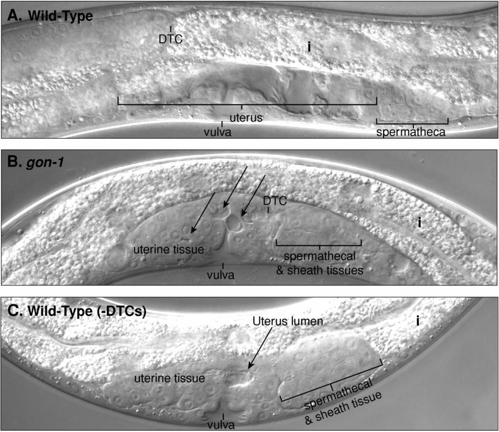 gon-1 and Gonadal Morphogenesis 385 FIG. 2. gon-1 gonads are severely malformed. Nomarski differential interference contrast (DIC) images. Tissues are defined by their cellular morphology.