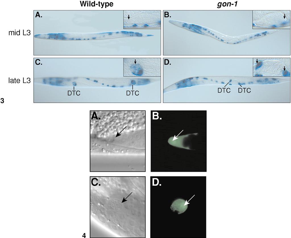 gon-1 and Gonadal Morphogenesis 387 FIG. 3. unc-5 is expressed in gon-1(q518) DTCs at late L3 stage. -Gal staining of wild-type (A, C) and gon-1 (B, D) animals carrying unc-5 5 lacz(nls) transgene.