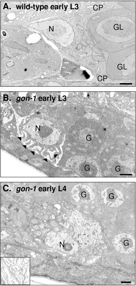 gon-1 and Gonadal Morphogenesis 389 FIG. 7. Sheath differentiation in wild-type and gon-1(q518) adult hermaphrodites.
