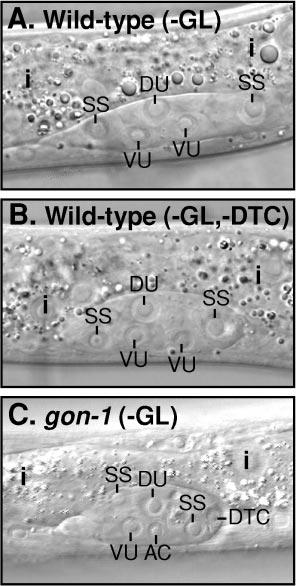 390 Blelloch et al. DISCUSSION gon-1 Governs Morphogenesis of the C. elegans Gonad In this paper, we show that the gon-1 gene governs two distinct events that are essential for shaping the C.