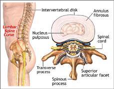 intervertebral disks (nucleus