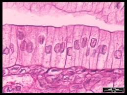 Epithelial tissue for linings Tightly packed cells Simple epithelium is 1 layer