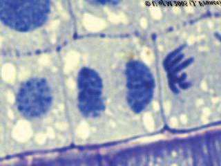 In anaphase, the chromosomes split. Each half is pulled toward the point where the spindle fibers come together.