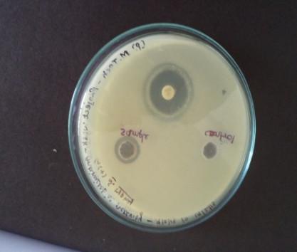 Staphylococcus aureus, Salmonella typhi
