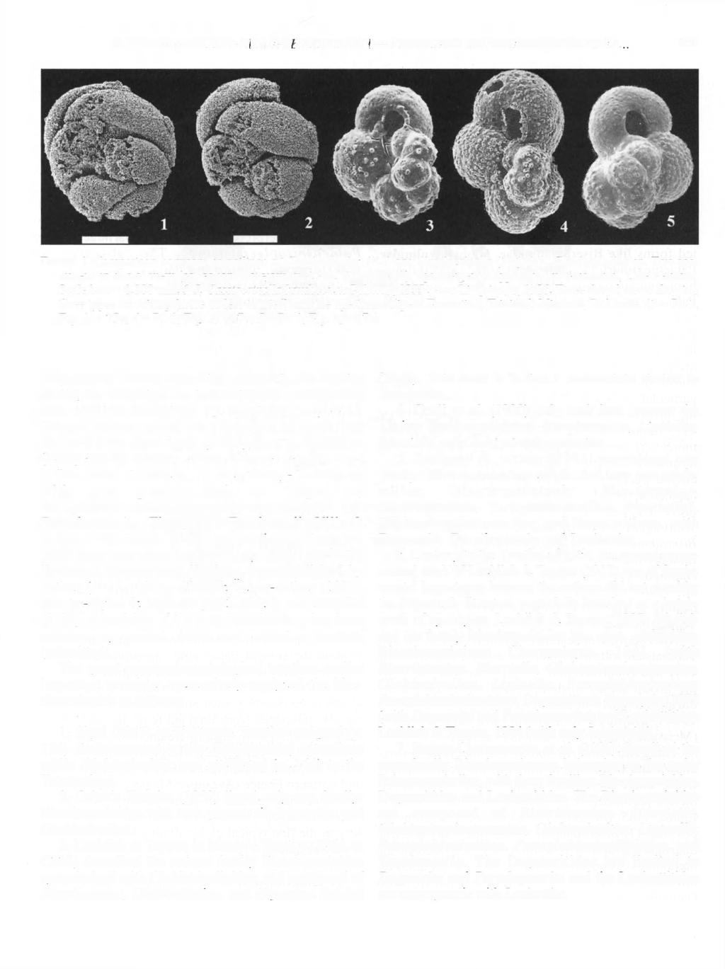 VACHARD-GAILLOT-PILLE-BEAZEJOWSKI PROBLEMS ON BISERIAMMINOIDEA... 455 FIGURE 1-Comparison between the coilings of Globivalvulina (1-2) and Cassigerinella (3-5). 1-2, Globivalvulina sp.