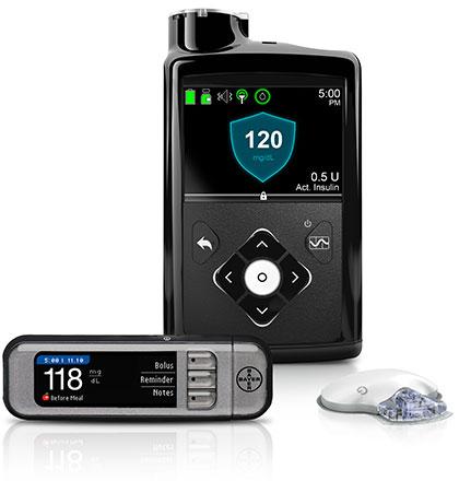 Artificial Pancreas Closed-loop (with feedback) control of insulin treatment for Type 1 diabetes.