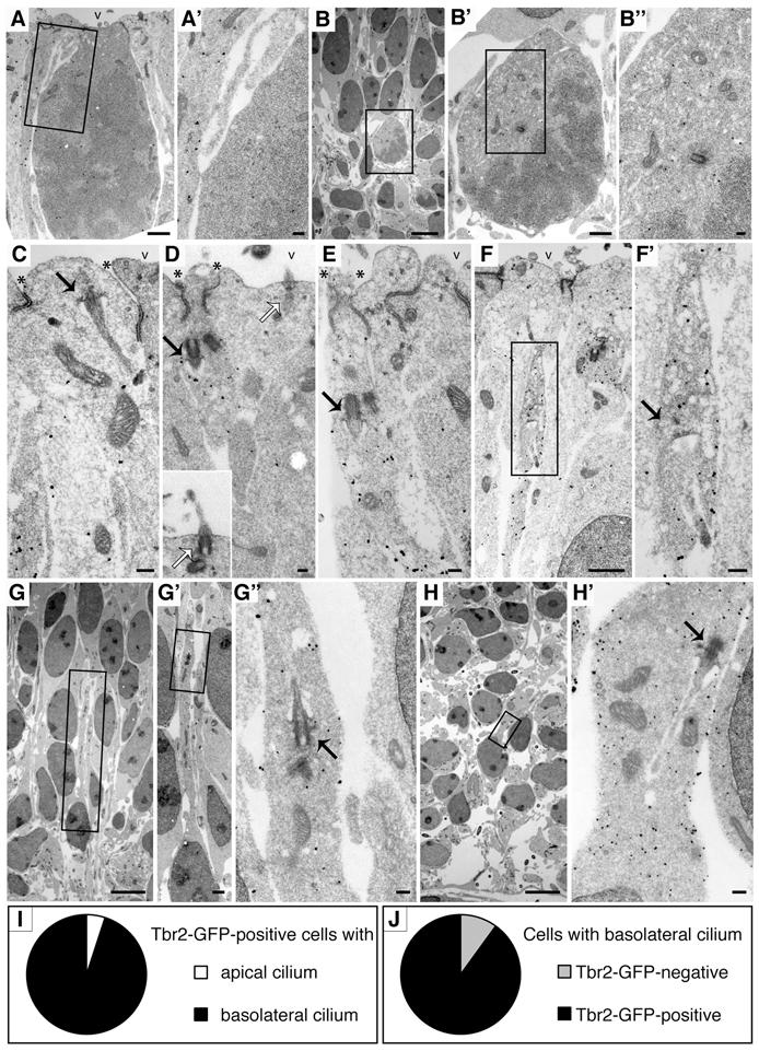 100 Development 139 (1) Fig. 3. Bl-cilia and neurogenesis. Bl-cilia increase with progression of neurogenesis.