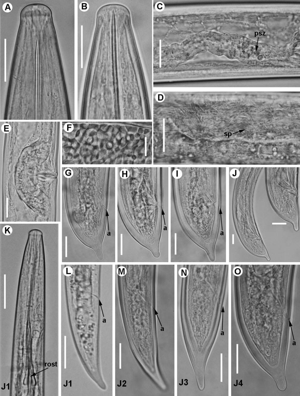 560 C. GUTIÉRREZ-GUTIÉRREZ ET AL. Figure 5. Light micrographs of Xiphinema turdetanensis sp. nov. A, B, female lip region. C, detail of pseudo-z-organ. D, detail of uterine spines. E, vulval region.