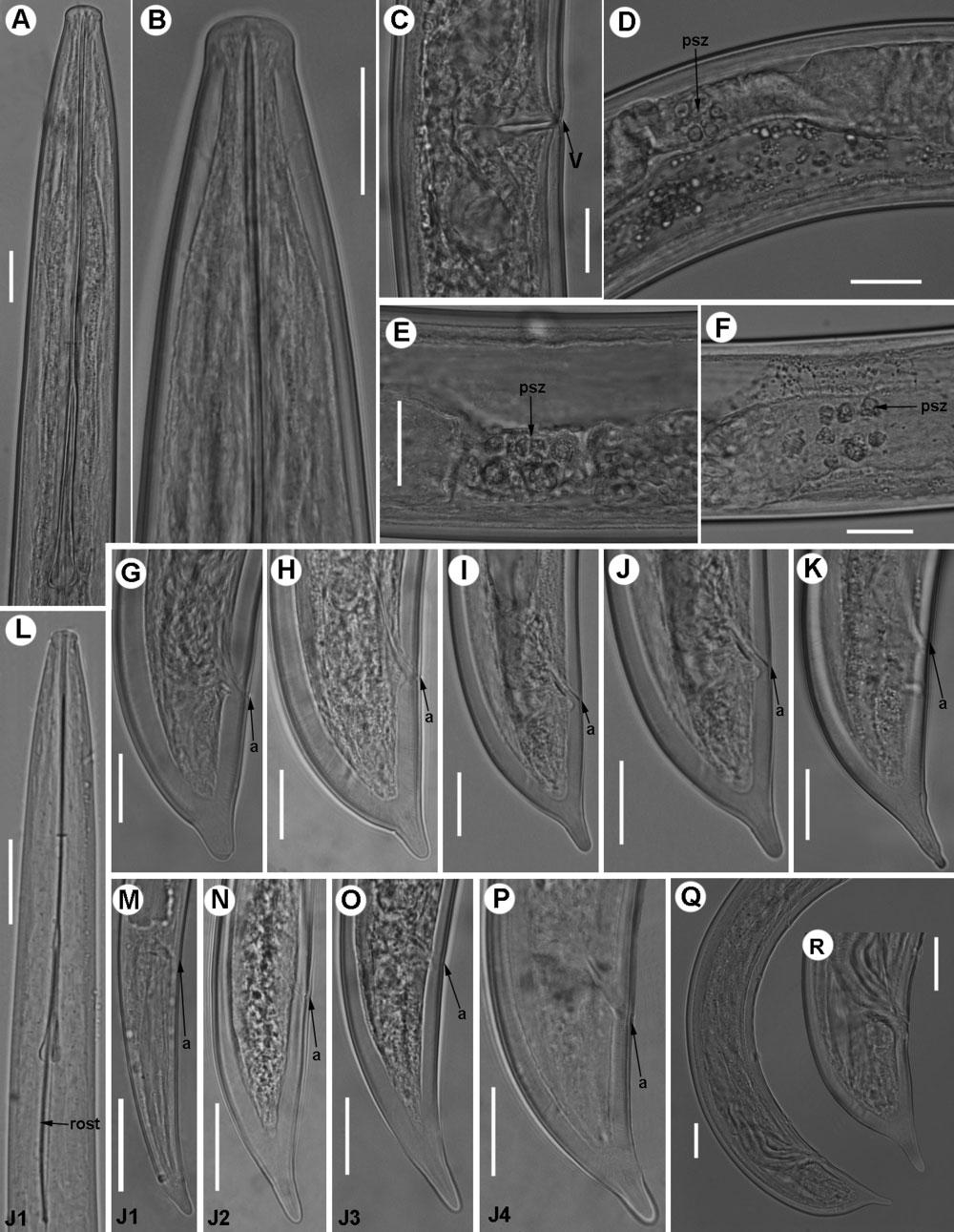 MOLECULAR PHYLOGENY OF XIPHINEMA 555 Figure 2. Light micrographs of Xiphinema baetica sp. nov. A, B, female lip region. C, vulval region. D F, detail of pseudo-z-organ. G K, female tail regions.