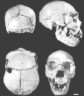 Views of Homo heidelbergensis skull. (Photograph: Javier Trueba/Madrid Scientific Films) Body structure Sometimes called a large Homo erectus with a bigger brain capacity.
