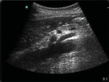 typical of diagnostic ultrasound