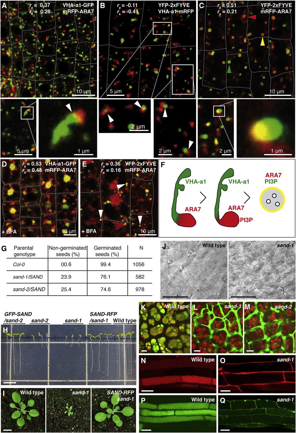 Current Biology Vol 24 No 12 1384 Figure 1. Spatial Relationship of TGN and MVB Markers, sand Mutant Phenotype, and Membrane Trafficking Defects (A) Localization of VHA-a1-GFP and mrfp-ara7.