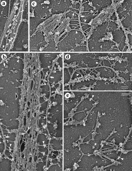 Intermediate filaments provide a supportive framework. Association of plectin with myosin II. (a) REF-52 cytoskeleton with actin filaments decorated by myosin S1 (black arrow).