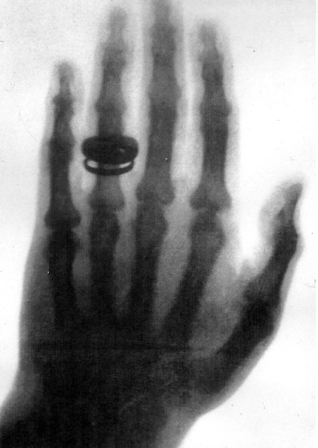First x-ray picture November