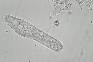 11 Observe how the paramecium moves, bumping off of objects, twisting and turning. Scientific Name: Paramecium sp.