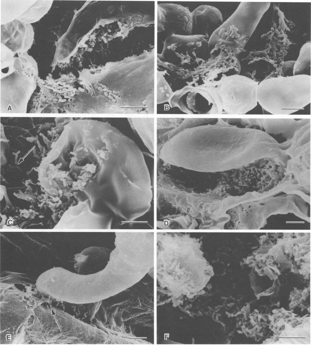 VOL. 55, 1989 NOTES 535 FIG. 2. Scanning electron micrographs of apple leaves and blossoms treated, respectively, with pathogenic strains L795 and L195 of P. syringae 