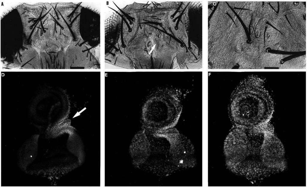 3568 J. Royet and R. Finkelstein Fig. 5. Increasing periods of OTD induction rescue progressively medial head structures in ocelliless flies.