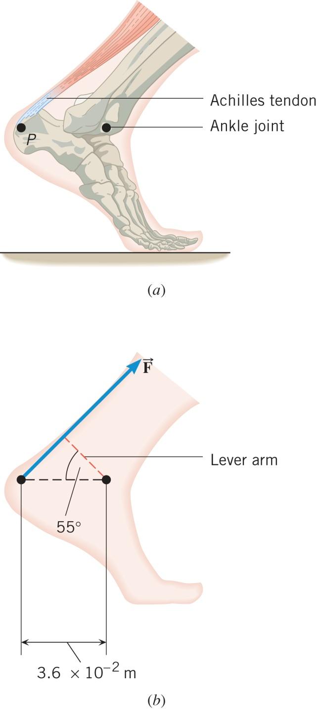 9.1 The Action of Forces and Torques on Rigid Objects Example The Achilles Tendon The tendon exerts a