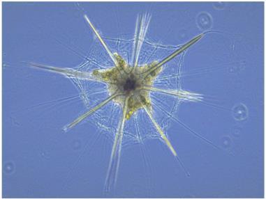 Amoebozoa in the Unikonta clade.