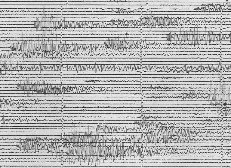 Volcanic Precursors - Seismic Volcanic tremor Volcanic tremor or Harmonic tremor: A rhythmic continuous ground motion recorded by seismographs during or preceding an eruption Associated with the
