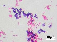Cell Walls Identifying Prokaryotes A method called gram staining tells them apart. Does the bacterium take up the gram stain? Gram stain = crystal violet and saphrine.