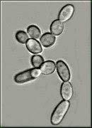 Examples of microbe uses Fungi: 1. Saccharmyces cerevisiae - yeast - used in bread, beer and wine-making. 2.