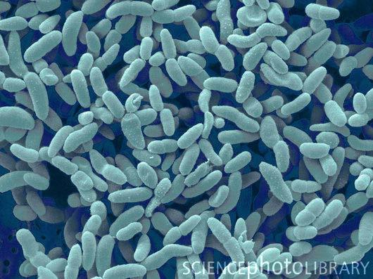Examples of microbe uses bacterium: 1. Lactococcus lactis - bacterium - producer of metabolites which kill other bacteria, especially spores from Clostridia botulinum which causes food poisoning.