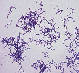 Have thick layer of peptidoglycan (protein-sugar complex). Single lipid layer. Stain purple. Can be treated with antibiotics.