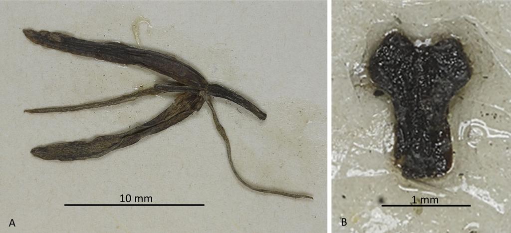 170 LANKESTERIANA Figure 5. Details from scan of Pleurothallis crocodiliceps Rchb.f. holotype: A. whole flower; B. lip glued to herbarium sheet.