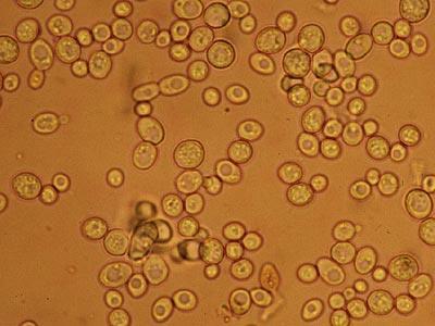 FUNGI Yeasts reproduce by budding or sporulation ferment carbohydrates