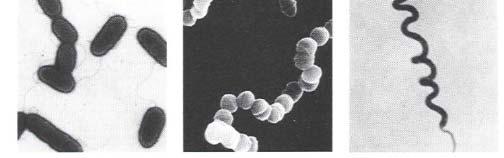 et al 2002 Spherical coccus (Enterococcus) Pseudomonas aeruginosa Streptococcus Spirillum volutans Bacterial Form Rod-shaped bacillus (E.