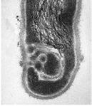 Vibrio cholerae (pathogen responsbible for cholera); the unsheathed core visible at top of photo is composed of a single crystal of the protein flagellin. Bacteria swim by rotating their flagella.