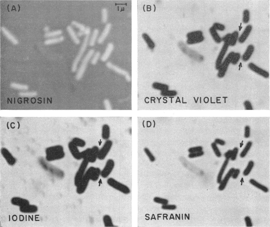 80 BARTHOLOMEW AND FNKELSTEN [VOL. 75 (8) (C) ODNE, CRY (D) L._ S: SAFRANN V OLET -.9U:. { t _ -_141.._ Figure 2. Gram stain of Escherichia coli.