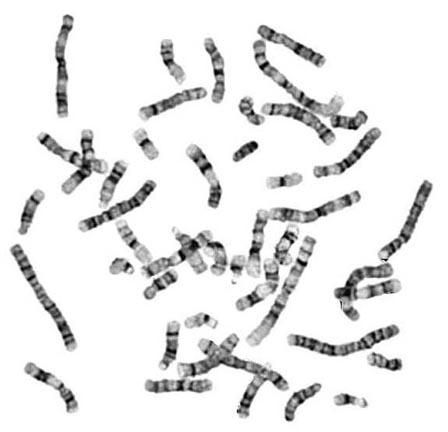 Chromosome folding pattern is reproducible Each chromosome has its own characteristic folding pattern variations in level of folding