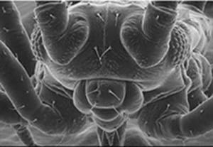 Electron Microscope Electron microscope picture of a fly. The resolving power of an optical lens depends on the wavelength of the light used.