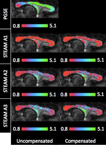 Figure 5: Maps of the axon diameter index [11] over the mid-sagittal corpus callosum recovered from the