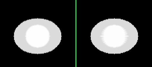 Comparison with Appearance Averaging Only Need for Shape Update Initial Image A SyN Result Initial Image B Intensity Average Intensity averaging does not fully correct blurring