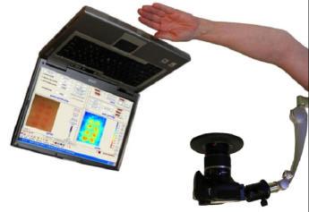1. INTRODUCTION The Skin Damage Visualizer TiVi60 is a polarization spectroscopy camera software package intended for visualization and assessment of the extension of skin areas plagued with erythema