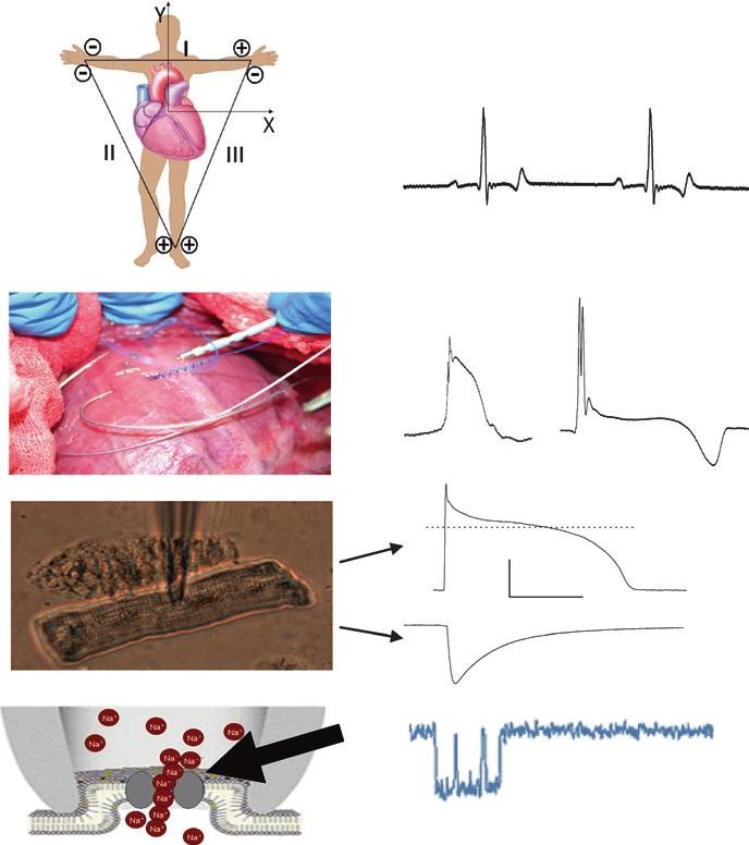 50 D.A. Jaye et al. a Lead II ECG b c RV-EGM RA-EGM LV apex LV base 0 mv ICa 50 mv AP 100 ms d closed open Fig..5 Different levels of cardiac electrophysiological recordings.