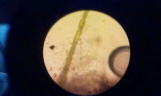 Figure 5: Microscopic images of anti algal activity of nanosilver