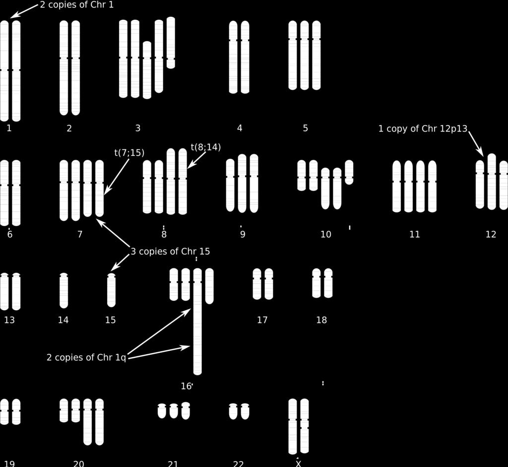 Genome Rearrangement Problems with Single and Multiple Gene Copies: A Review 7 Fig. 3 A schematic of the karyotype of the T47D breast cancer cell line.