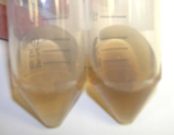 Figure 1. The color of the extract solution is used as an indicator of when the extraction is complete.