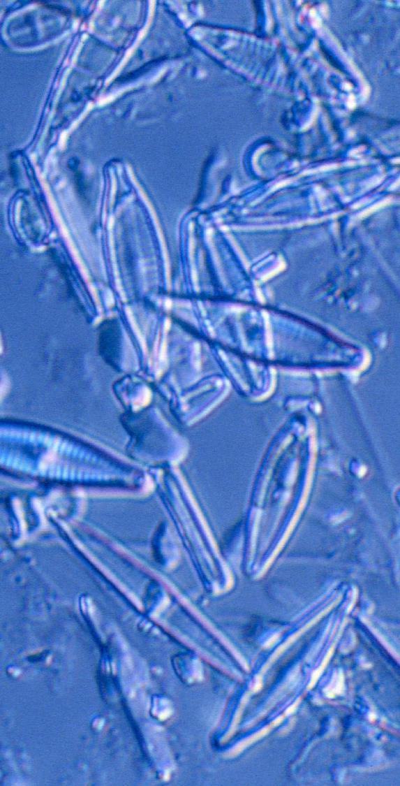 DIATOMS Phylum Bascillariophyta Ecological Importance Basis of the food chain in both marine and freshwater environments