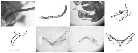 tibial spur, scale line represents 0.25 mm. G-P: Male. G: Frontal view of head; H: Dorsal view of propodeum; I: Lateral view of antenna; J: Drawing of antenna, scale line represents 0.