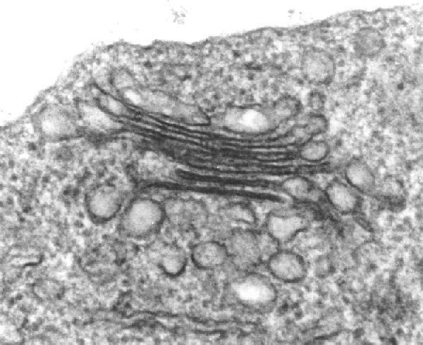 ELECTRON MICROGRAPH OF GOLGI APPARATUS stacked membranes Golgi vesicles