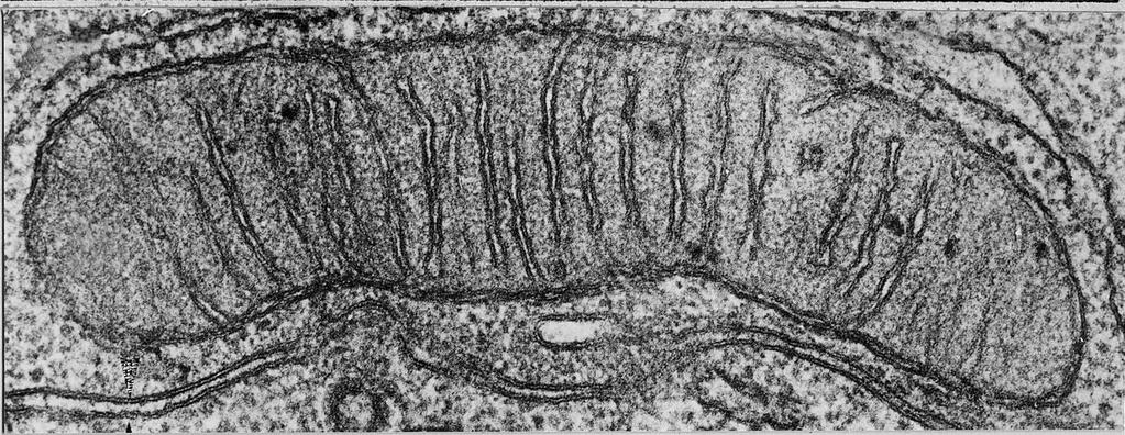 ELECTRON MICROGRAPH OF MITOCHONDRION Courtesy of Electron Microscopy Unit University of Lancaster