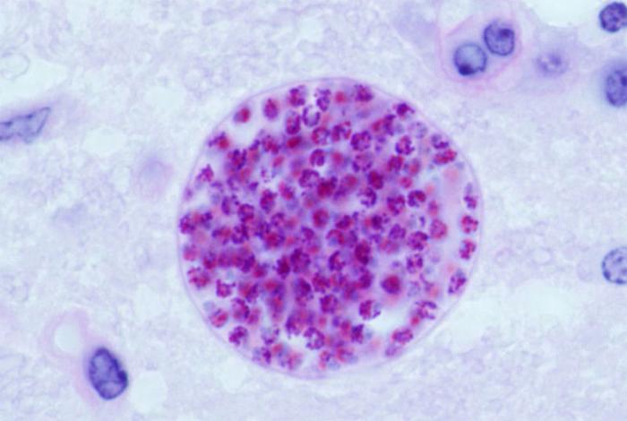 RBFD: cat, mouse, parasite Toxoplamsa
