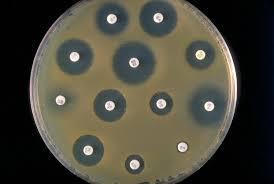 Agar petri dishes demonstrating zone of inhibition = area
