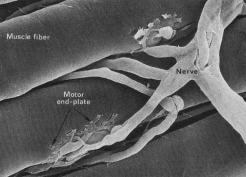 W Peasgood et al thigh, lower leg and arm. A skeletal muscle such as that in a thigh is predominately made up of muscle fibres.